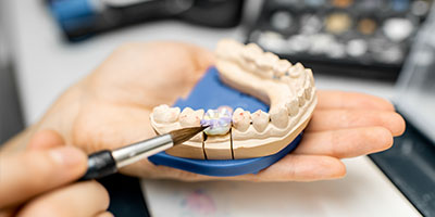 Tooth Removal